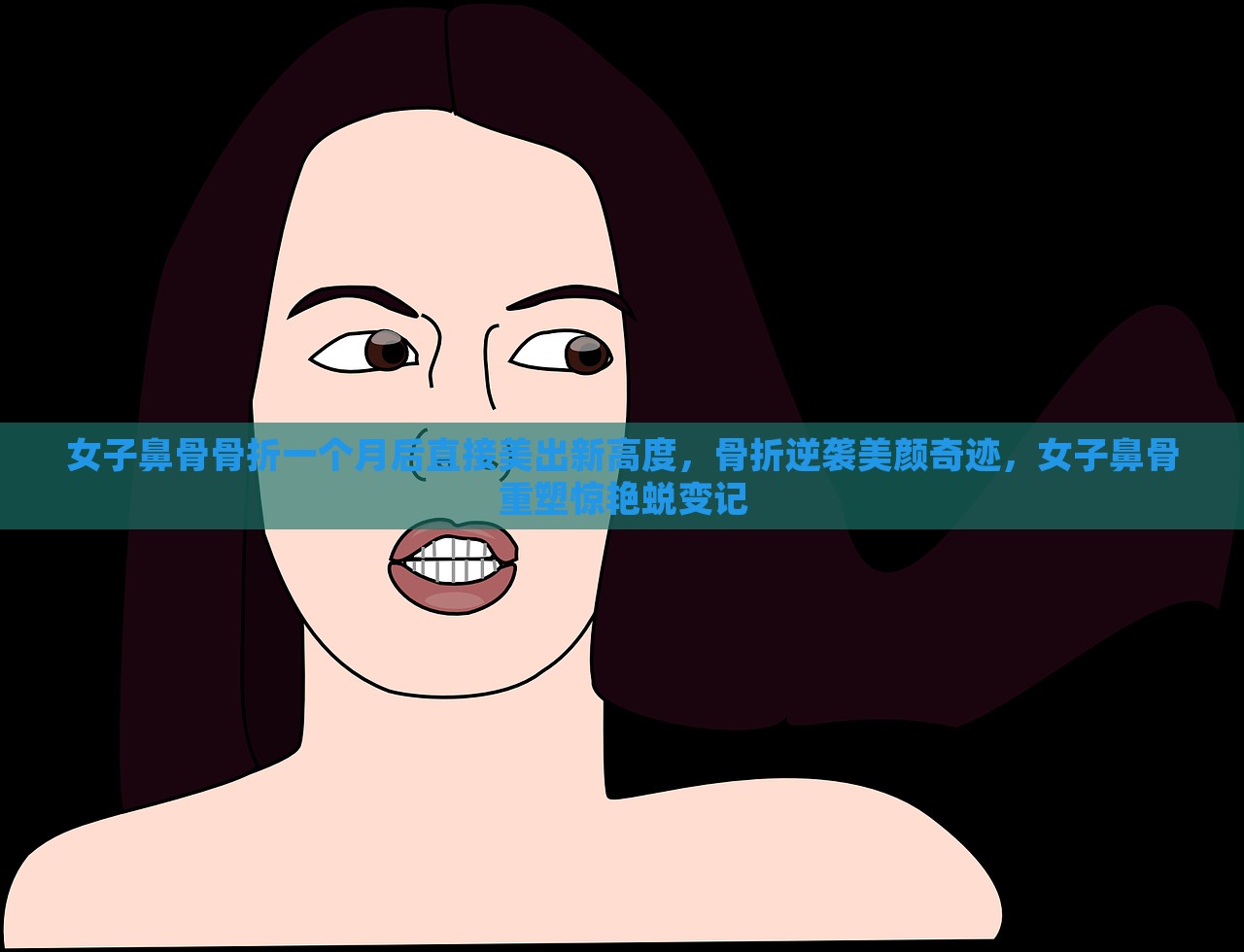 女子鼻骨骨折一个月后直接美出新高度，骨折逆袭美颜奇迹，女子鼻骨重塑惊艳蜕变记，女子鼻骨骨折重塑惊艳蜕变，逆袭美颜奇迹一个月后的惊艳蜕变记